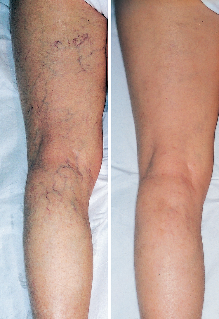 Gambe di Laura
